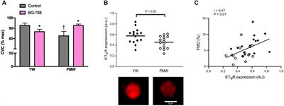 ET-1 as a Sex-Specific Mechanism Impacting Age-Related Changes in Vascular Function